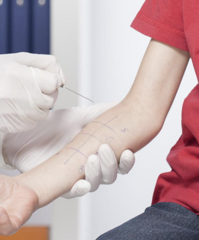 Preguntas frecuentes sobre Alergólogo cerca de Mundo Estado de México